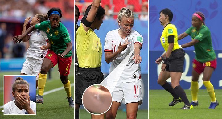 Tuding Dicurangi FIFA, Timnas Wanita Kamerun Histeris Kalah dari Inggris